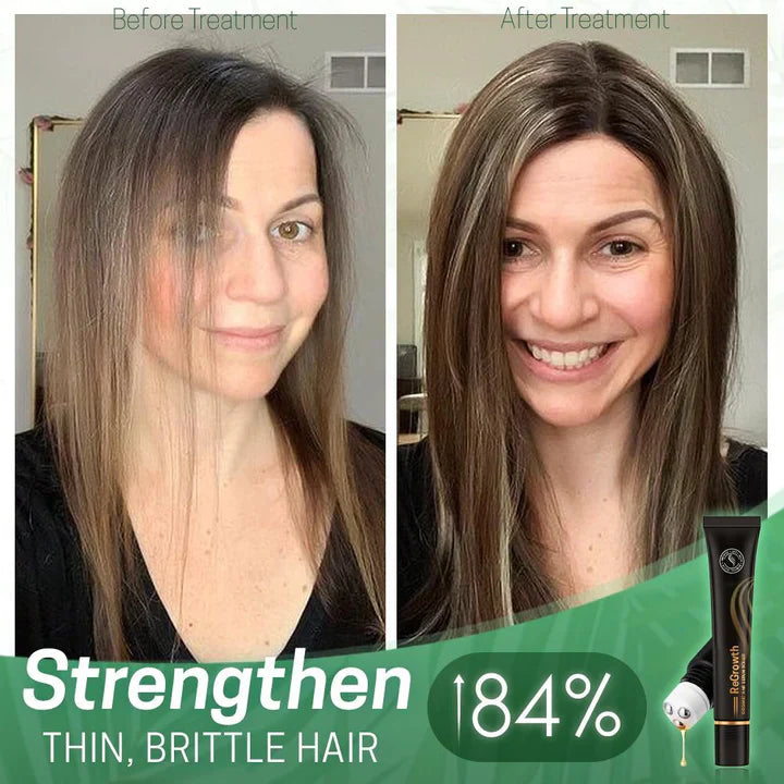 StrandSurge Serum — Hair Growth Serum with Roller Applicator