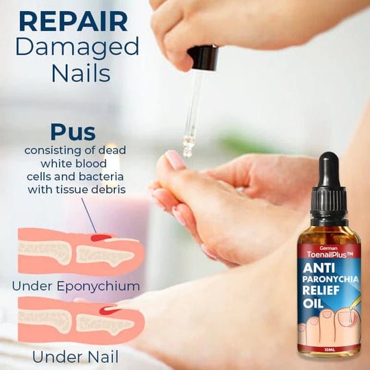 ToenailPlus - Anti-Paronychia Ingrown Toenail Care Oil