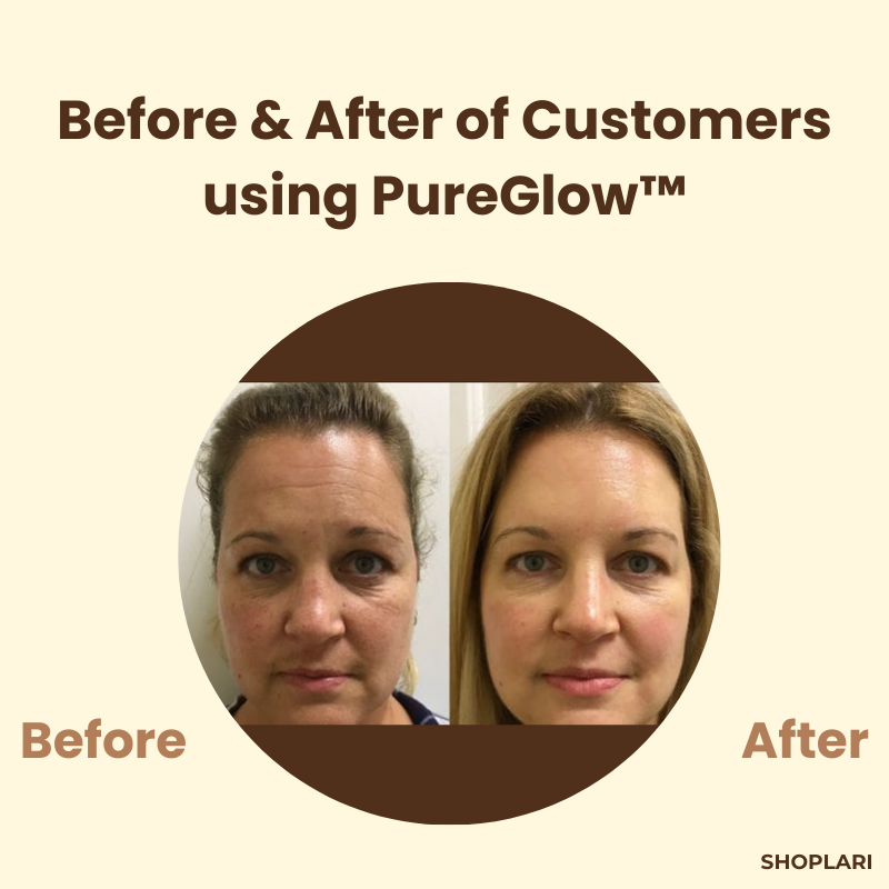 PureGlow - Peel Off Face Mask for Facial Skincare Routine