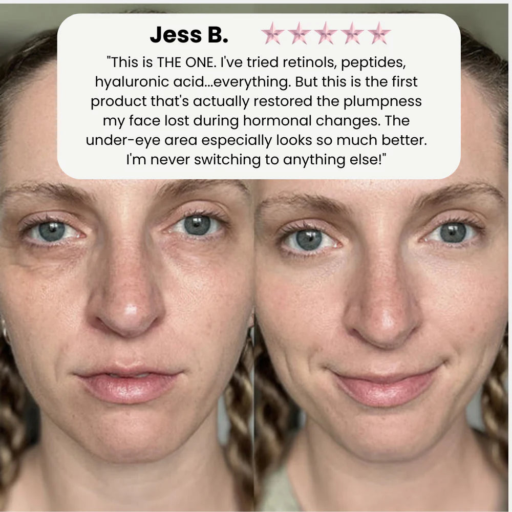 VivaDerm — Dual-Layer Collagen Cream-in-Serum