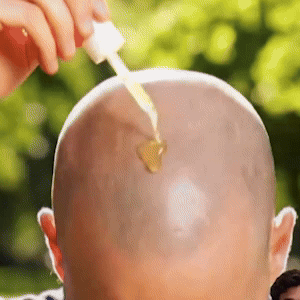 FollicleFuel - Hair Care Serum for Scalp & Hair Routine