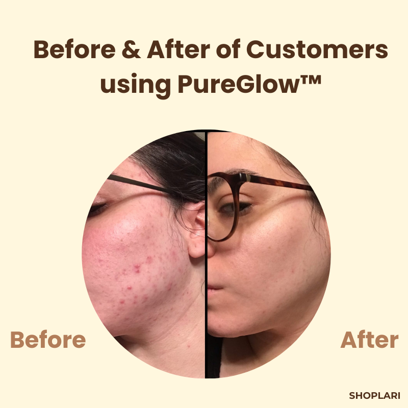 PureGlow - Peel Off Face Mask for Facial Skincare Routine